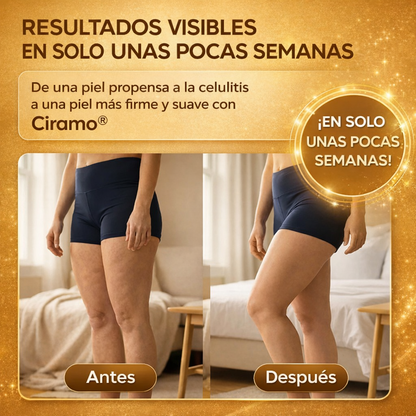 Ciramo® Masajeador Anticelulitis Pro